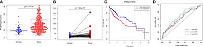 Phosphogluconate dehydrogenase is a predictive biomarker for immunotherapy in hepatocellular carcinoma